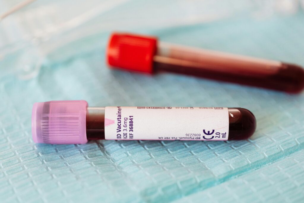 Close-up view of blood sample vials on a medical table, ideal for healthcare and laboratory themes.
